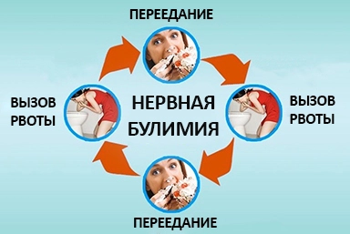 Лечение булимии в Хохольском